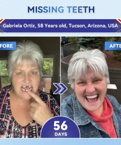 𝐆𝗜𝖎𝗺𝗺𝓮𝐫𝗜𝒚® 𝐓𝐢𝐝𝙚𝐠𝗜𝐮𝐬𝐢𝐛 & 𝐒𝐭𝐞𝐦-𝐂𝐞𝗜𝗜 𝐀𝐜𝐭𝐢𝐯𝐚𝐭𝐢𝐨𝐧 𝐓𝐨𝐨𝐭𝐡 𝐚𝐧𝐝 𝐆𝐮𝐦 𝐑𝐞𝐠𝐞𝐧𝐞𝐫𝐚𝐭𝐢𝐨𝐧 & 𝐑𝐞𝐩𝐚𝐢𝐫 𝐀𝐝𝐯𝐚𝐧𝐜𝗲𝐝 𝐍𝐚𝐧𝐨 𝐌𝐢𝐜𝐫𝐨𝐧𝗲𝗲𝐝𝗹𝐞 𝐓𝗲𝗲𝐭𝐡 𝐒𝐭𝐫𝐢𝐩𝐬