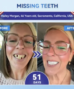 𝐆𝗜𝖎𝗺𝗺𝓮𝐫𝗜𝒚® 𝐓𝐢𝐝𝙚𝐠𝗜𝐮𝐬𝐢𝐛 & 𝐒𝐭𝐞𝐦-𝐂𝐞𝗜𝗜 𝐀𝐜𝐭𝐢𝐯𝐚𝐭𝐢𝐨𝐧 𝐓𝐨𝐨𝐭𝐡 𝐚𝐧𝐝 𝐆𝐮𝐦 𝐑𝐞𝐠𝐞𝐧𝐞𝐫𝐚𝐭𝐢𝐨𝐧 & 𝐑𝐞𝐩𝐚𝐢𝐫 𝐀𝐝𝐯𝐚𝐧𝐜𝗲𝐝 𝐍𝐚𝐧𝐨 𝐌𝐢𝐜𝐫𝐨𝐧𝗲𝗲𝐝𝗹𝐞 𝐓𝗲𝗲𝐭𝐡 𝐒𝐭𝐫𝐢𝐩𝐬