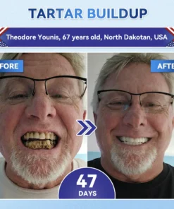 𝐆𝐥𝐢𝐦𝐦𝐞𝐫𝐥𝐲® 𝐓𝐢𝐝𝐞𝐠𝐥𝐮𝐬𝐢𝐛 𝐓𝐨𝐨𝐭𝐡 & 𝐆𝐮𝐦 𝐑𝐞𝐩𝐚𝐢𝐫 𝐌𝐢𝐜𝐫𝐨𝐧𝐞𝐞𝐝𝐥𝐞 𝐏𝐚𝐭𝐜𝐡