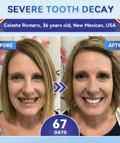 𝐆𝐥𝐢𝐦𝐦𝐞𝐫𝐥𝐲® 𝐓𝐢𝐝𝐞𝐠𝐥𝐮𝐬𝐢𝐛 𝐓𝐨𝐨𝐭𝐡 & 𝐆𝐮𝐦 𝐑𝐞𝐩𝐚𝐢𝐫 𝐌𝐢𝐜𝐫𝐨𝐧𝐞𝐞𝐝𝐥𝐞 𝐏𝐚𝐭𝐜𝐡