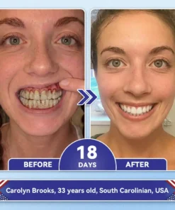 Glimmerly® Tideglusib Tooth & Gum Repair Fast-Dissolving Oral Strips