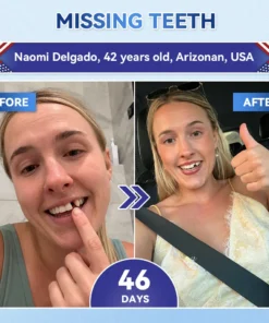 Glimmerly® Tooth & Gum Repair Clinical-Grade Microneedle Patches